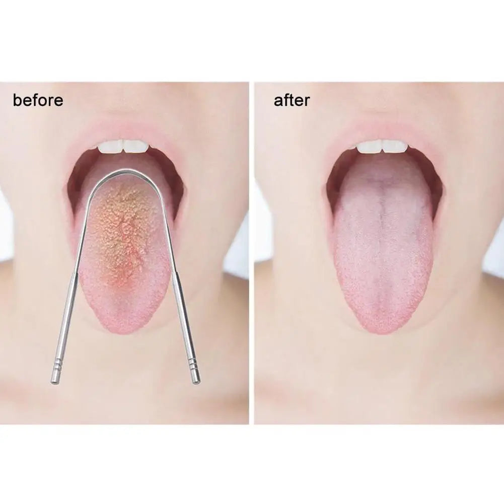 Tongue Scraper